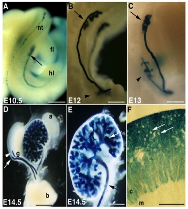 HNF1β expression during kidney organogenesis